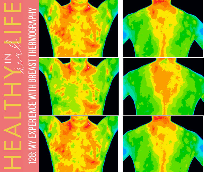 128: my experience with breast thermography
